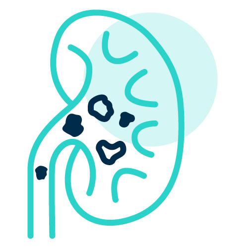 Renal Detox Therapies