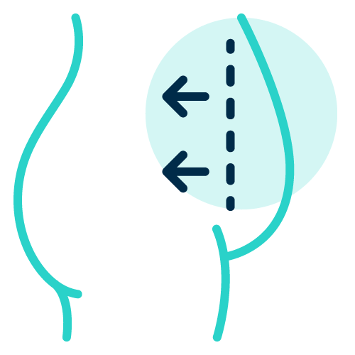 Abdominal Sculpting Technologies