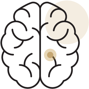 Stroke Prevention